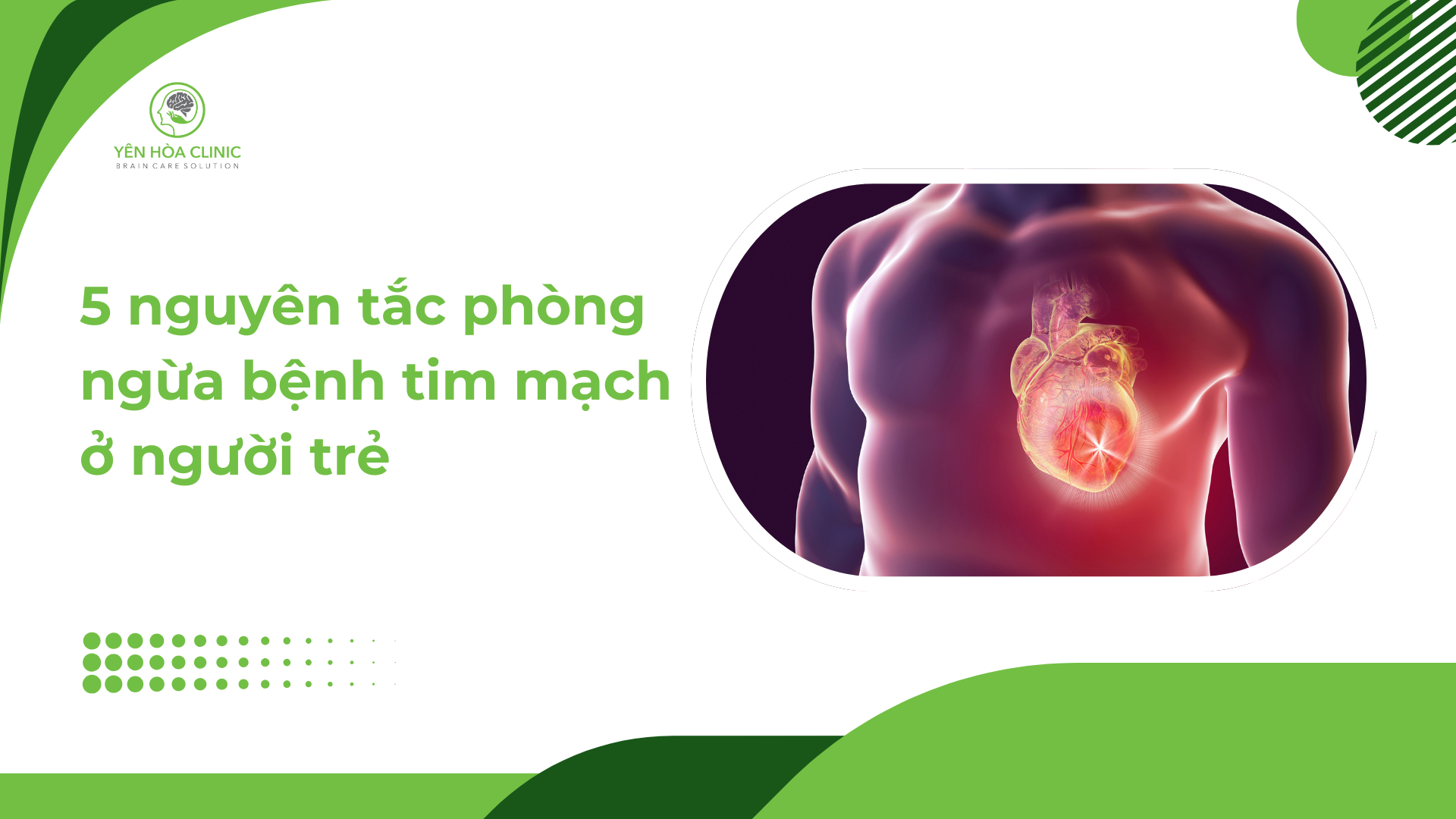 5 Nguyên Tắc Phòng Ngừa Bệnh Tim Mạch Ở Người Trẻ - Giải Pháp Chủ Động Từ Hôm Nay